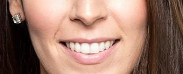 Физиогномика губы: определение характера человека, особенности, фото с описанием